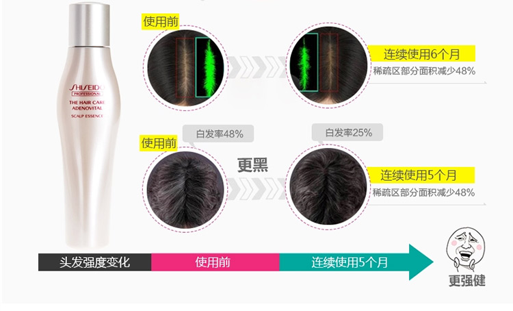 SHISEIDO/资生堂护理道 头皮生机系列 健发精华液 180ml